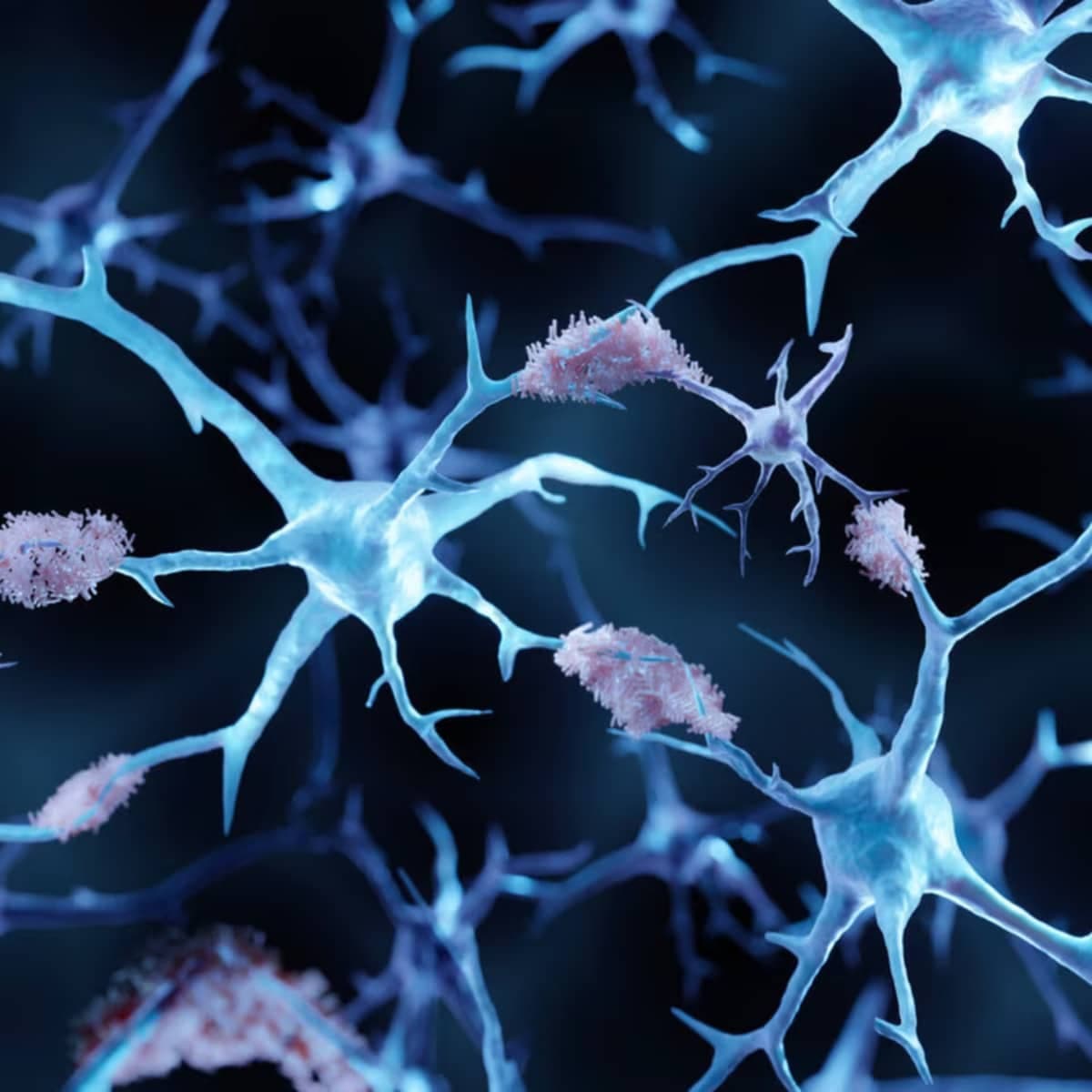 The Sleep-Alzheimer's Link: Why Big Pharma Doesn't Want You To Know The Real Cost of Lost Deep Sleep