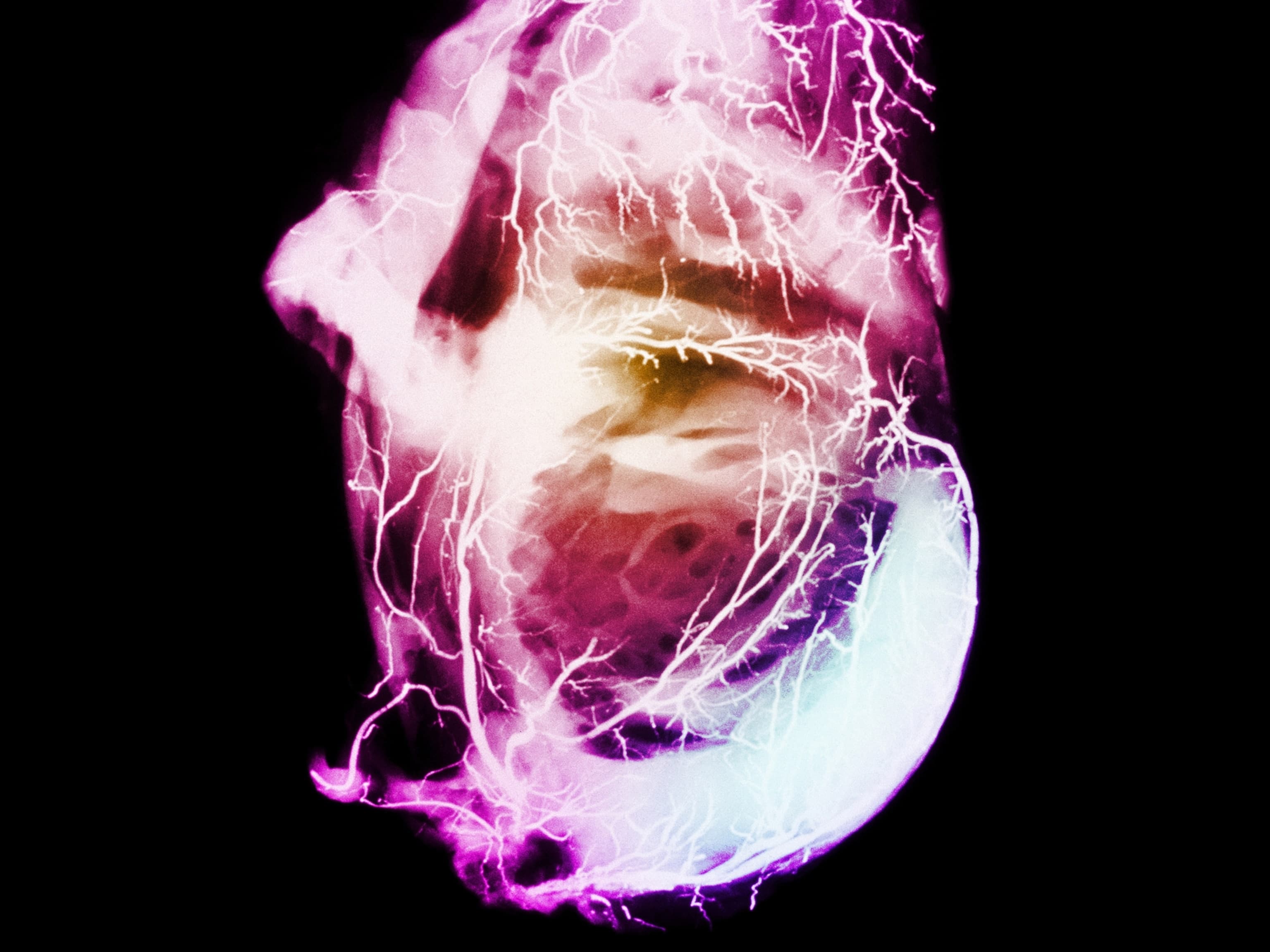 The Vitamin D Mirage: Why Your Supplement Isn't Stopping Your Heart Attack (And Who's Profiting) - Image 8