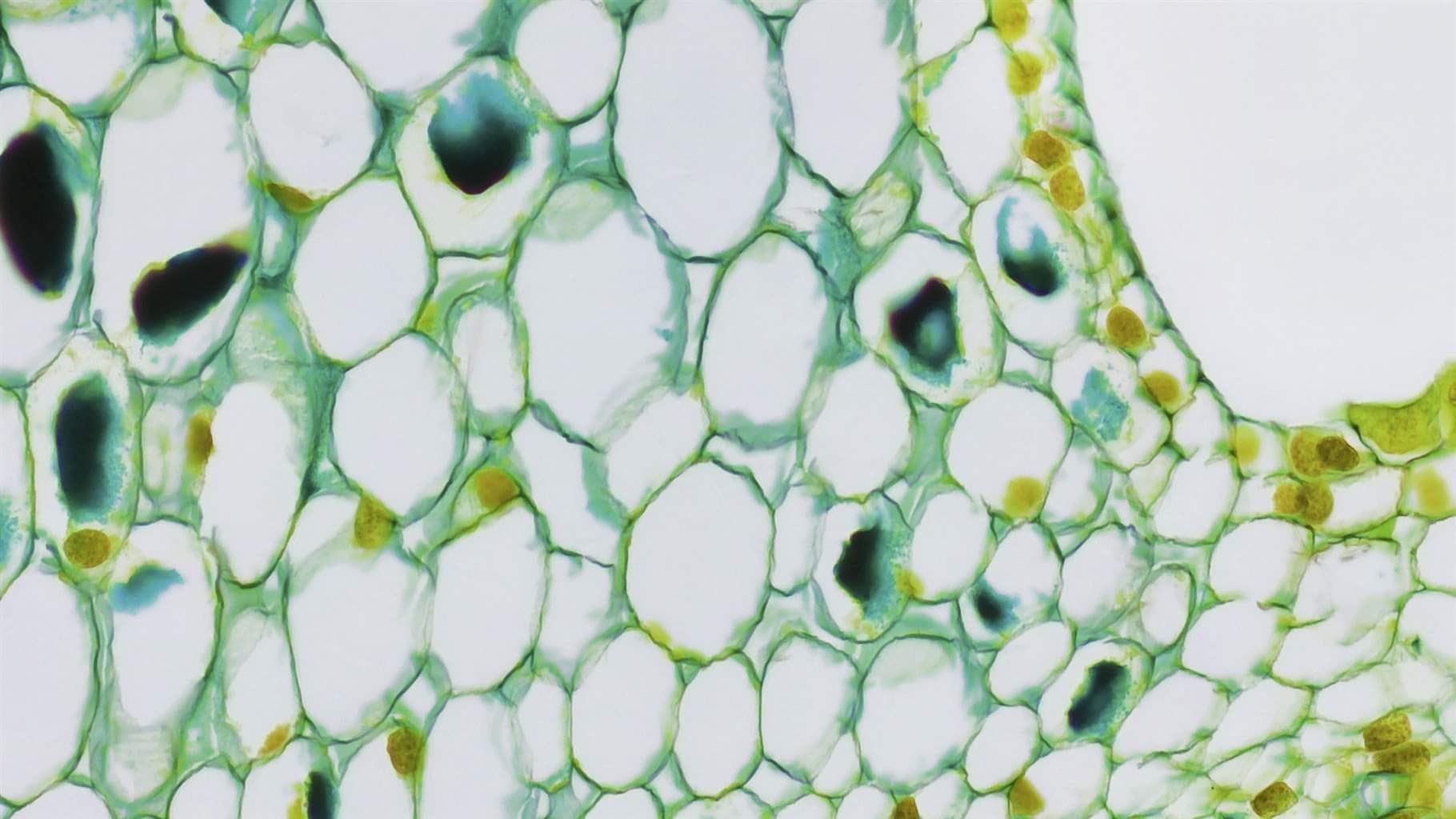 The Pew Grants Are A Trojan Horse: Who Really Wins When 7 Teams 'Transform Biomedical Science'?